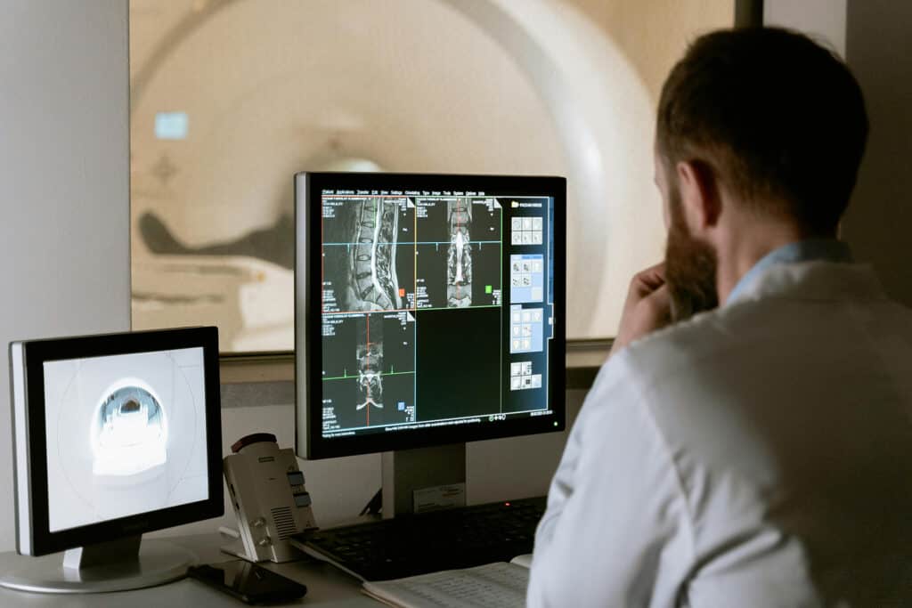 doctor reviewing scan of brain and spinal cord to diagnose central nervous system